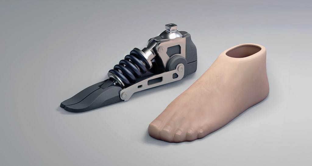 3D-модель протеза стопы